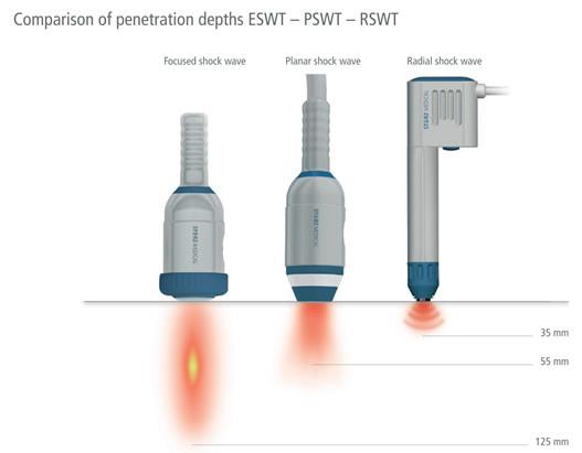 Focussed_vs_Radial_Shockwave