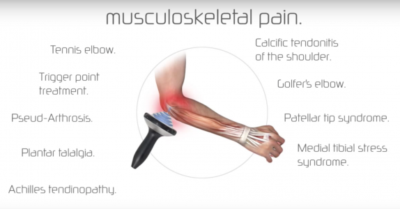 Musculoskeletal pain