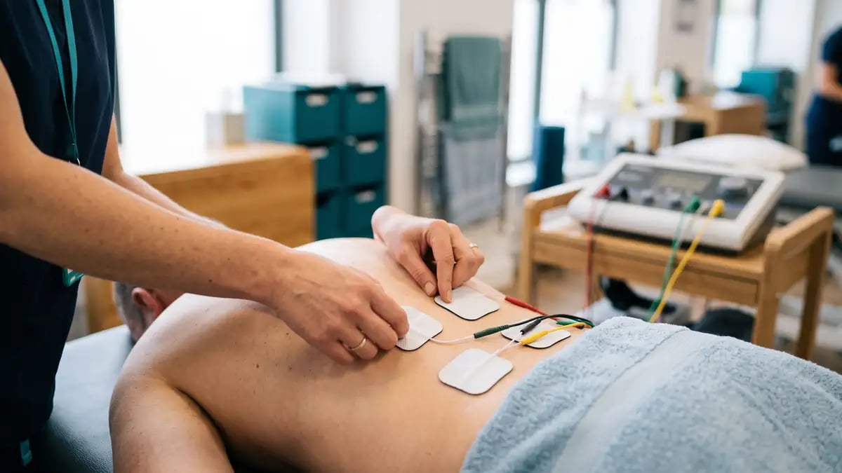 Close-up of four electrode pads being placed in a crossed quadripolar arrangement on a patient's lower back